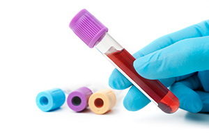 Blood tests