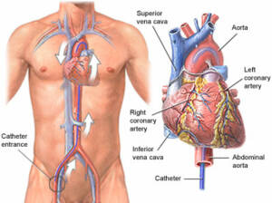 Interventional Cardiologist near you perform scardiac-catheterization
