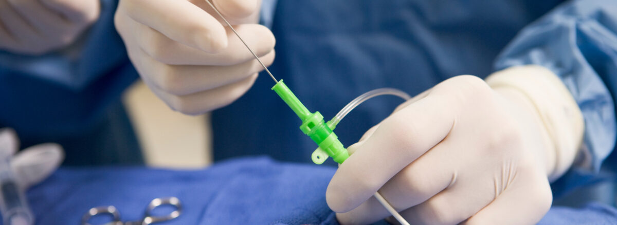 Ablation Therapy