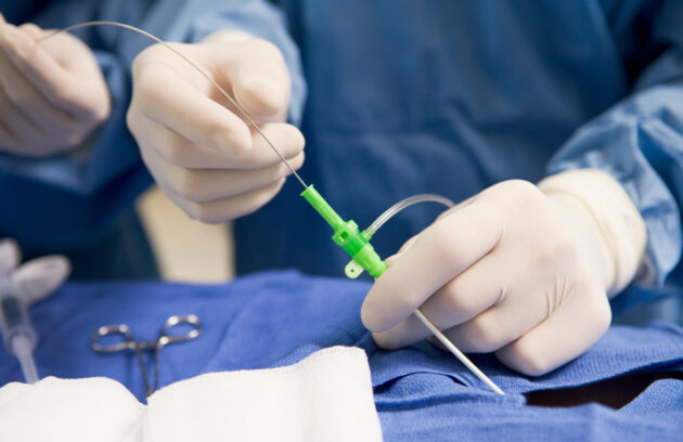 Ablation Therapy