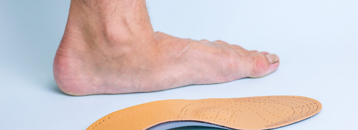 Flat Feet