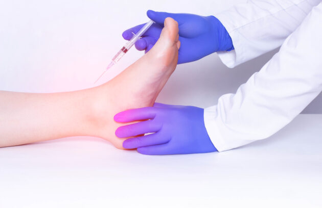 Corticosteroid Injections