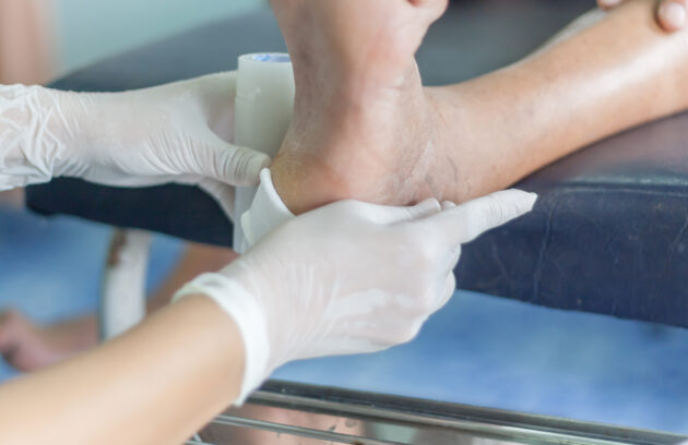 Diabetic Foot Care: Prevention and Management