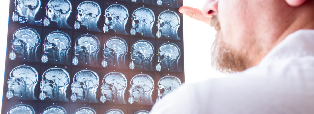 Pituitary Tumors