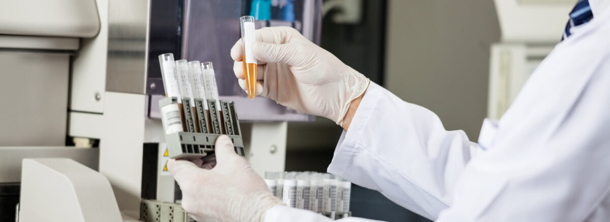 Urinalysis