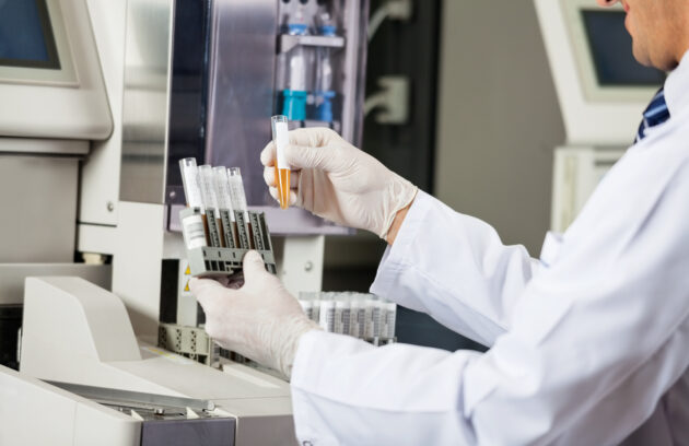Urinalysis