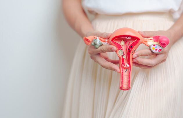Polycystic Ovary Syndrome (PCOS)