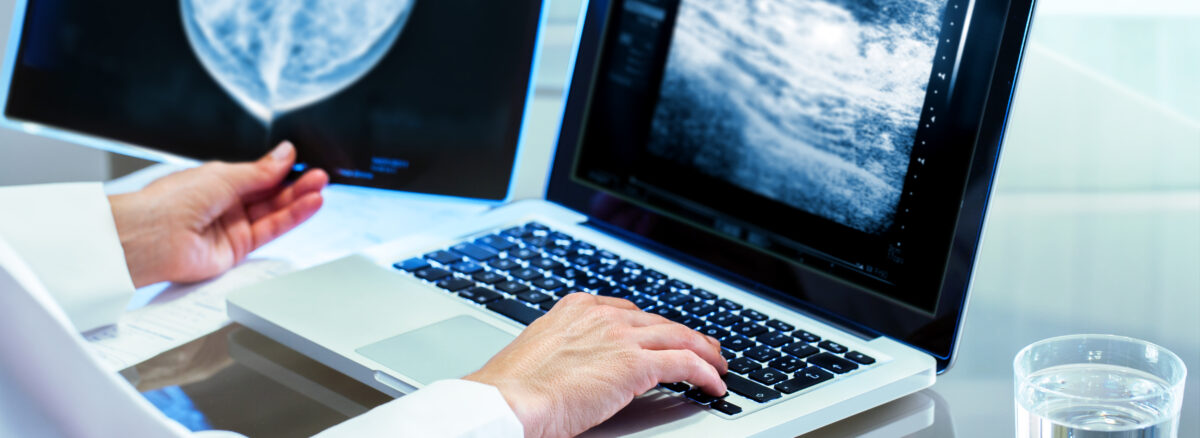 Understanding Mammography Referrals: Importance and Procedure