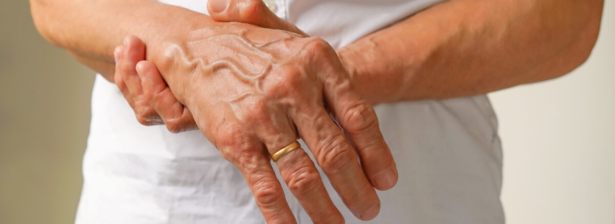 Autoimmune Disorders: When the Immune System Attacks