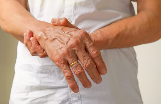 Autoimmune Disorders: When the Immune System Attacks
