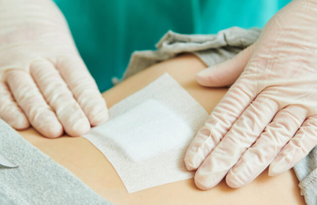 The Role of Blood Circulation in Wound Healing