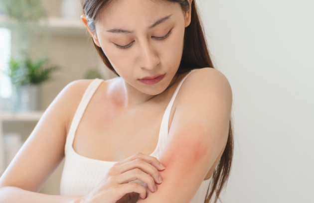 Advances in Biologics for Severe Allergic and Autoimmune Conditions