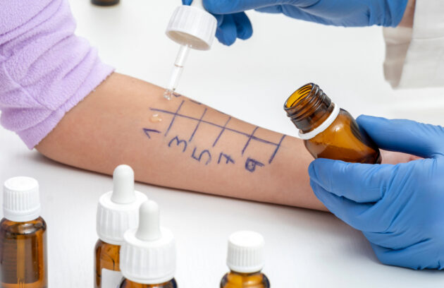 Understanding Histamine Intolerance: More Than Just Seasonal Allergies