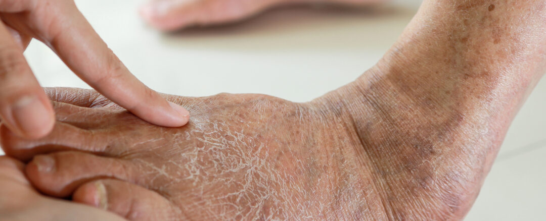 What Causes Numbness in the Feet and When to See a Doctor