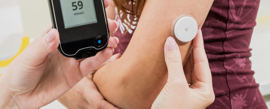 Advances in Continuous Glucose Monitoring for Optimizing Diabetes Management
