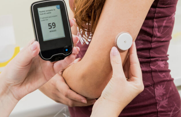 Advances in Continuous Glucose Monitoring for Optimizing Diabetes Management