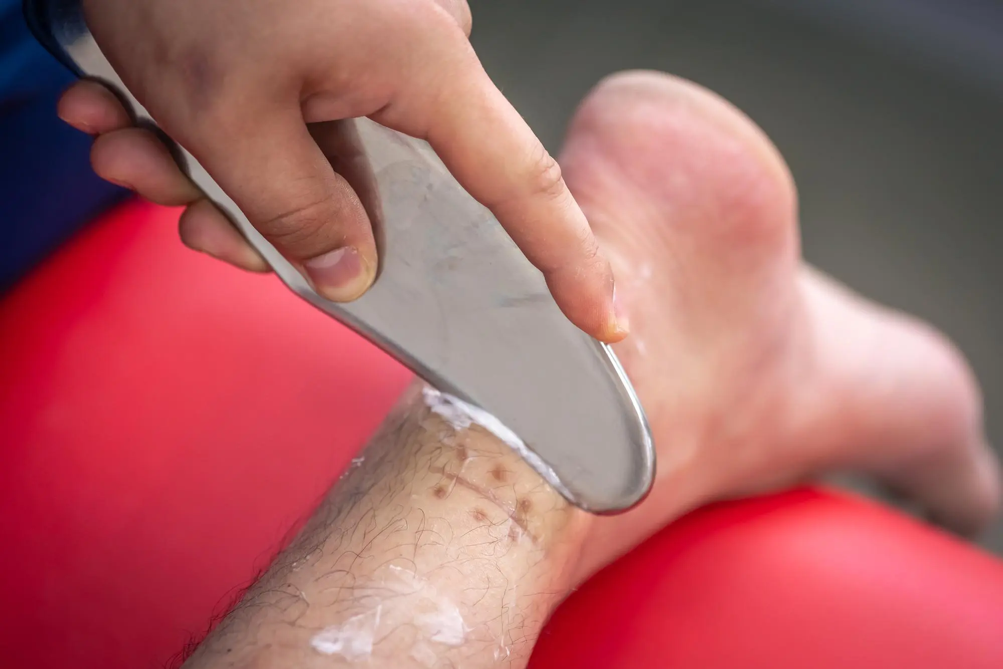 Wound Care Center