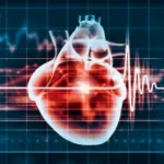 Electrocardiography